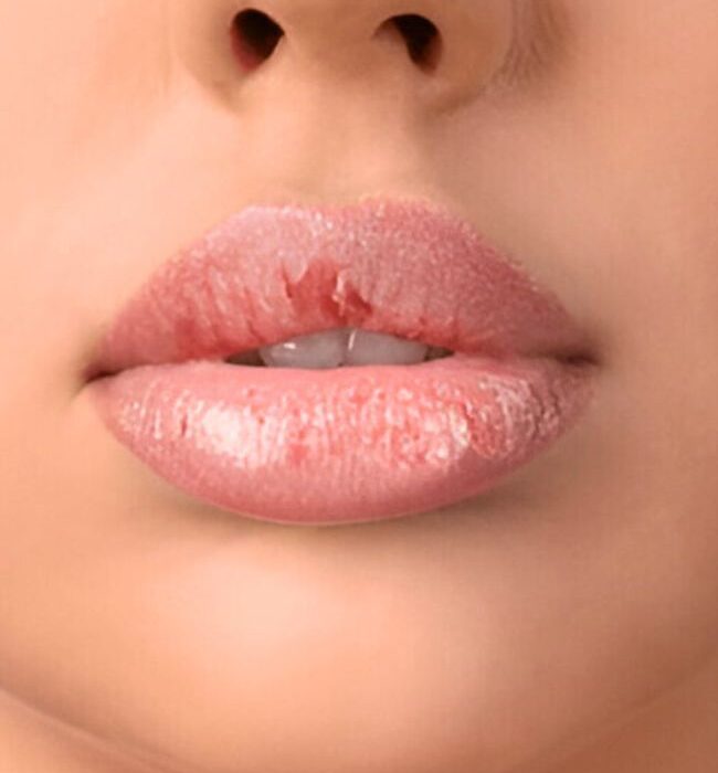 Repair Dry and Damage Lips